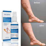 EELHOE Vein Massage Spray for Leg Pain Relief